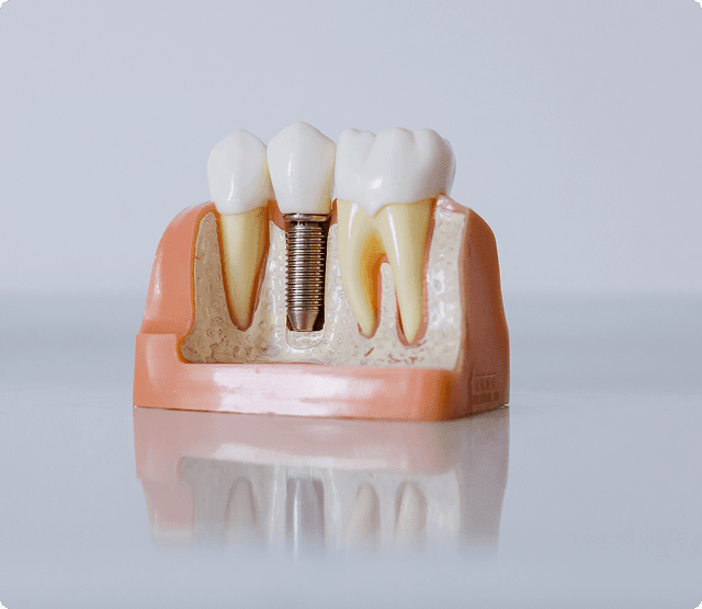 Dental examination showing preventive care with dental mirror
