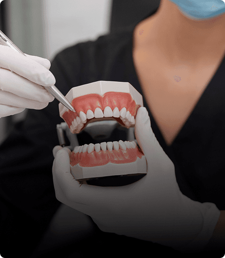 Dental Implants